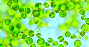 Image of microalgae