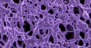 Membrane filter